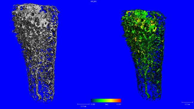 Representative micro-computed tomography images of trabecular bone